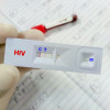 A rapid screening test for HIV